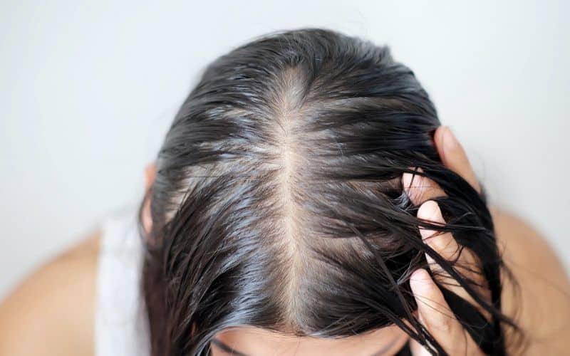 Understanding Oily Hair And The Causes Of It